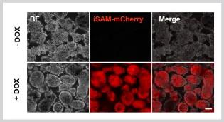 a grid of microscope images showing cells tagged with a fluorescent protein present or absent with different expression.