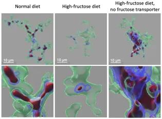 Computational image, representing brain immune cells called microglia (green), with internalised/cleared dead cell neuron-derived material (red). There is reduced dead cell clearance with high fructose that is then rescued by removal of the fructose transporters.