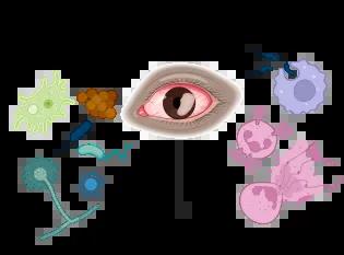 diagram showing that a cornea infection causing blindness is resultant on a microorganism entering the eye and the body's host immune response. 