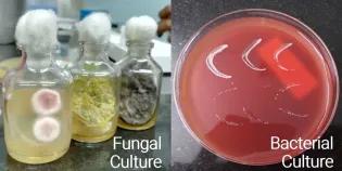 Left - fungal culture. Right - bacterial culture on agar plate