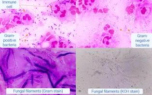 4 images of microscopy stains, with pink, purple and grey dyes showing bacteria or fungi.