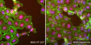 Two fluorescent microscopy images of cancer cells with drug VT-107 (left) causing less YAP activity inside the cell nucleus (magenta), with minimal impact on cell shape (green), compared to dasatinib drug (right).