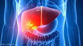 AI generated image of liver disease