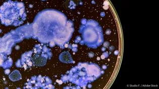 Close up of a petri dish with purple bacteria growing in colonies on the gel