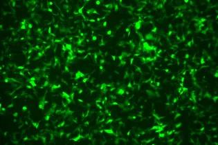 Fluorescent image of HEK293T cells expressing GFP, showing green signal indicating successful transfection. 