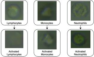 Three separate white blood cells as unactivated and activated 