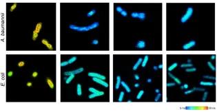 2 rows of 4, showing different teal and yellow fluorescence depending on the bacterial species
