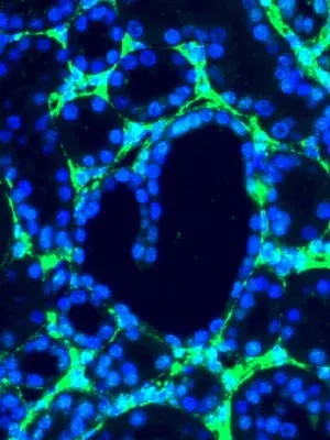 Image is showing collagen (green) of a kidney section with a heart shaped tubule