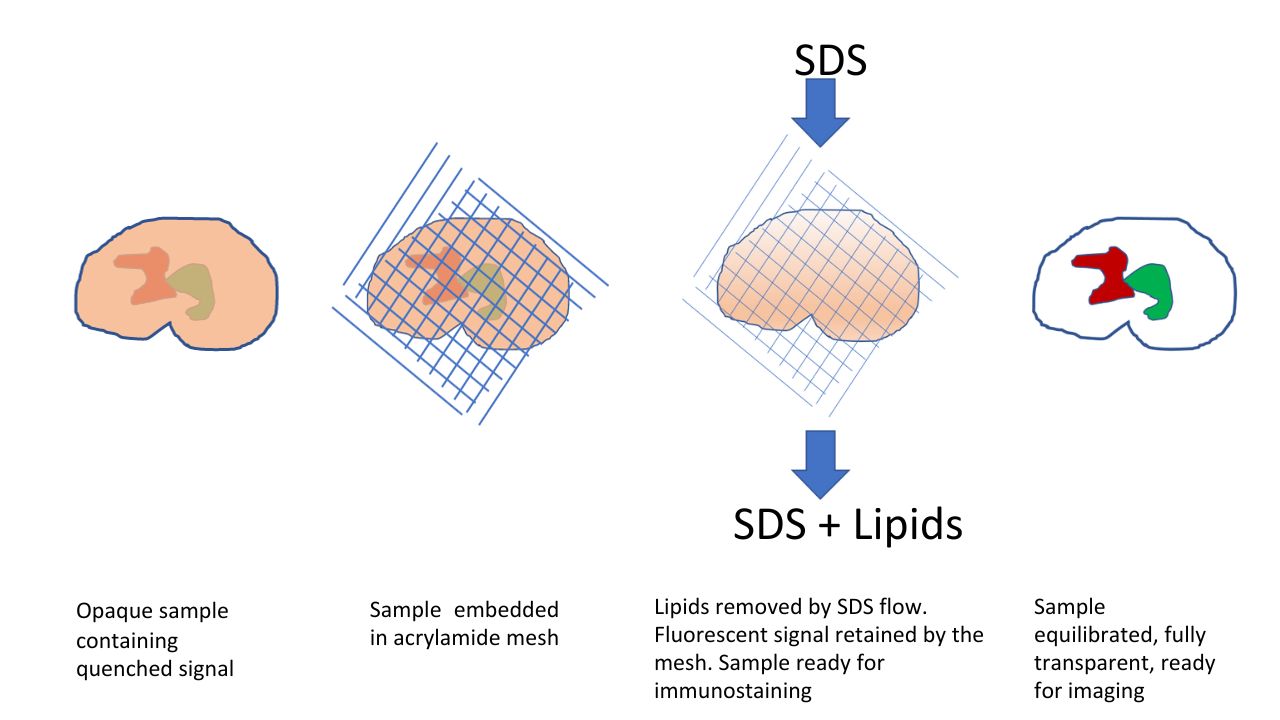 Infographic: 1. Opaque sample containing quenched signal. 2. Sample embedded in acrylamide mesh. 3. Lipids removed by SDS flow. Fluorescent signal retained by the mesh. Sample ready for immunostaining. 4. Sample equilibrated, fully transparent, ready for imaging.