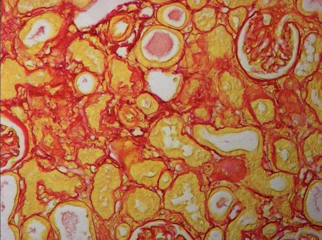 Histology imaging orange, yellow and white