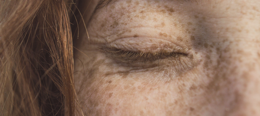 Skin health | Edinburgh Skin Network | Institute for Regeneration and ...